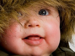 Обморожение щечек у детей фото