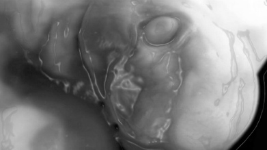 Фото Узи на 7 неделе беременности