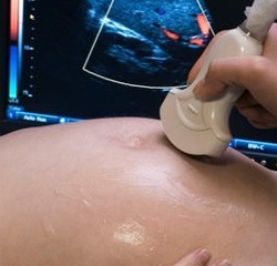 Ультразвуковое исследование (УЗИ) при беременности