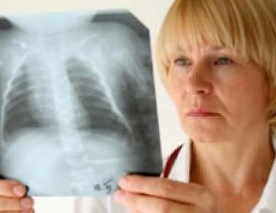 Рентген при беременности